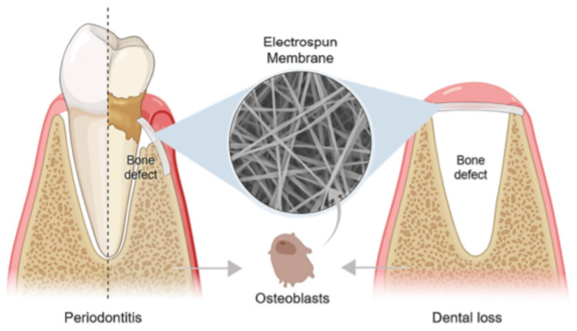an overview of application of silver nanoparticles for biomaterials in dentistry